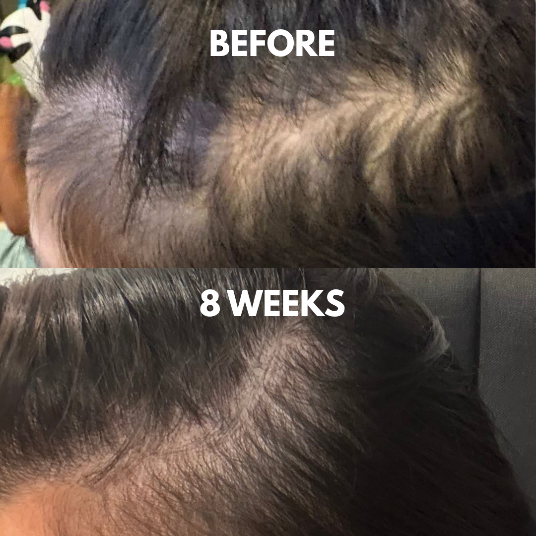 Advanced Peptide Hair Growth Serum