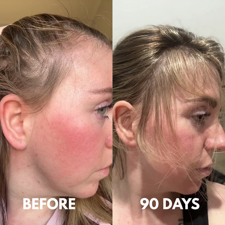 Advanced Multi-Peptide Hair Growth Serum