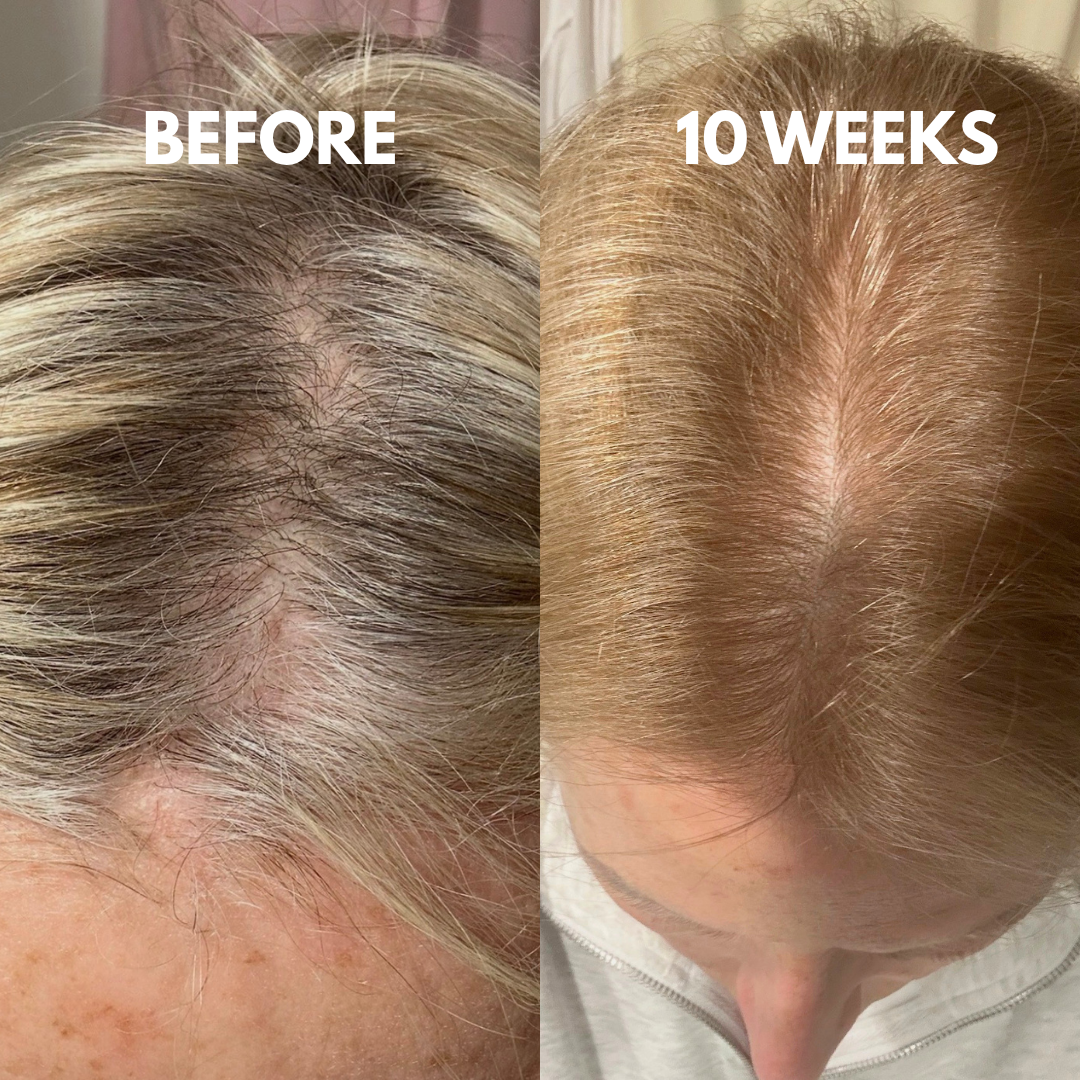 Advanced Peptide Hair Growth Serum