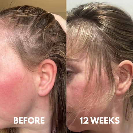 Advanced Peptide Hair Growth Serum