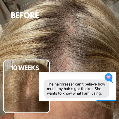 Advanced Peptide Hair Growth Serum