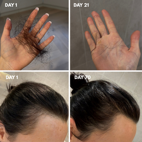Advanced Multi-Peptide Hair Growth Serum