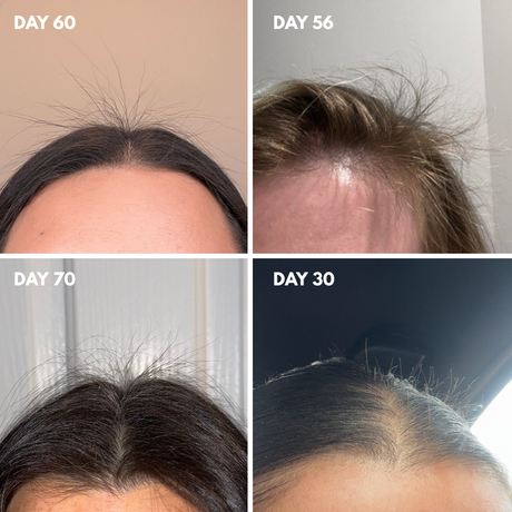 Advanced Multi-Peptide Hair Growth Serum