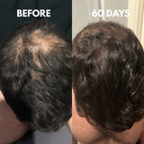 Advanced Multi-Peptide Hair Growth Serum