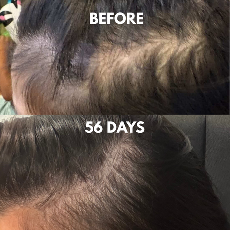 Advanced Multi-Peptide Hair Growth Serum
