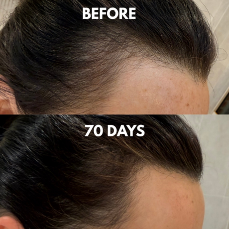 Advanced Multi-Peptide Hair Growth Serum