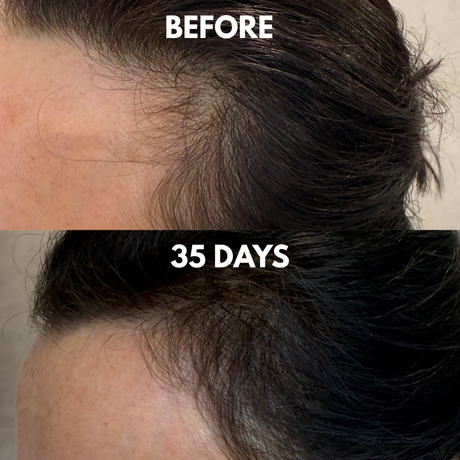 Advanced Multi-Peptide Hair Growth Serum