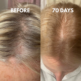Advanced Multi-Peptide Hair Growth Serum