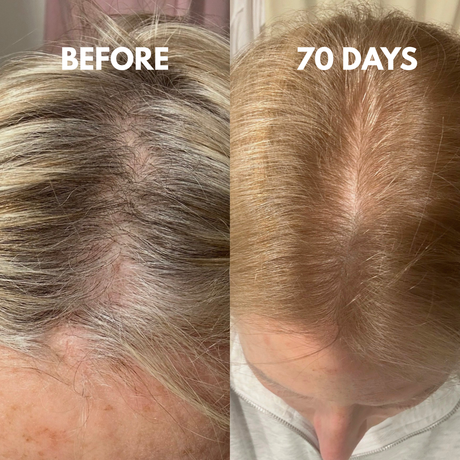 Advanced Multi-Peptide Hair Growth Serum