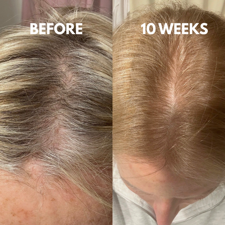 Advanced Peptide Hair Growth Serum