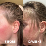 Advanced Peptide Hair Growth Serum